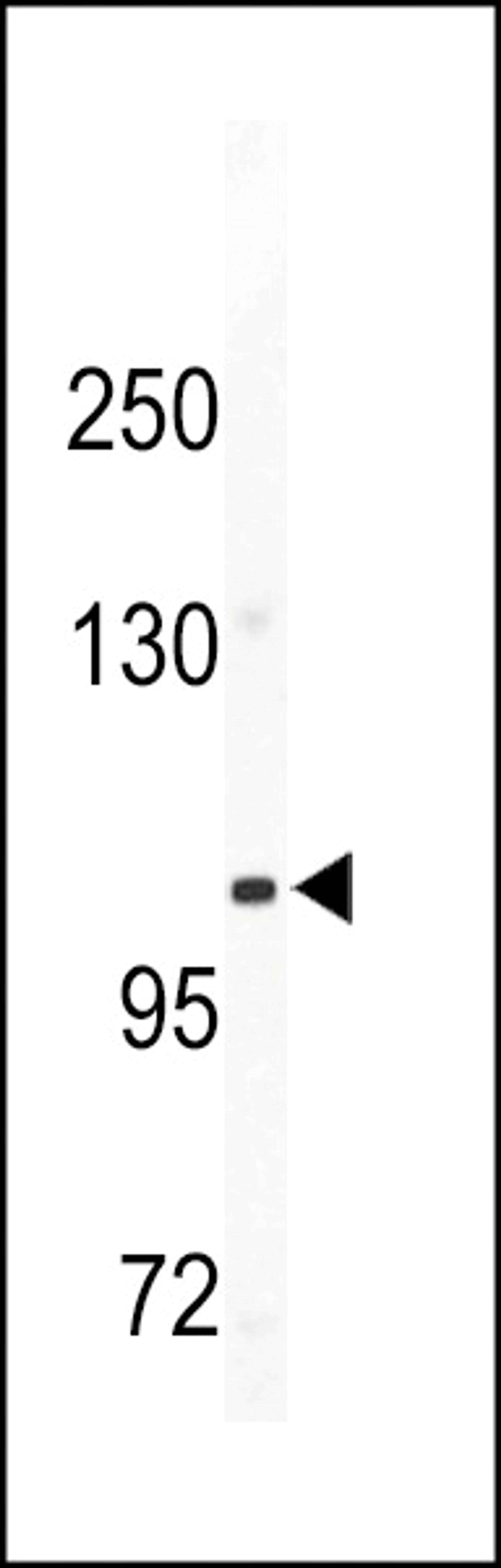 Western blot analysis of CD49e antibody in mouse bladder tissue lysates (35ug/lane)