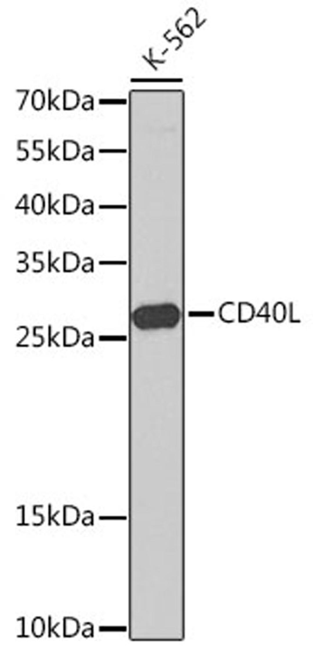 Western blot - CD40L antibody (A13002)