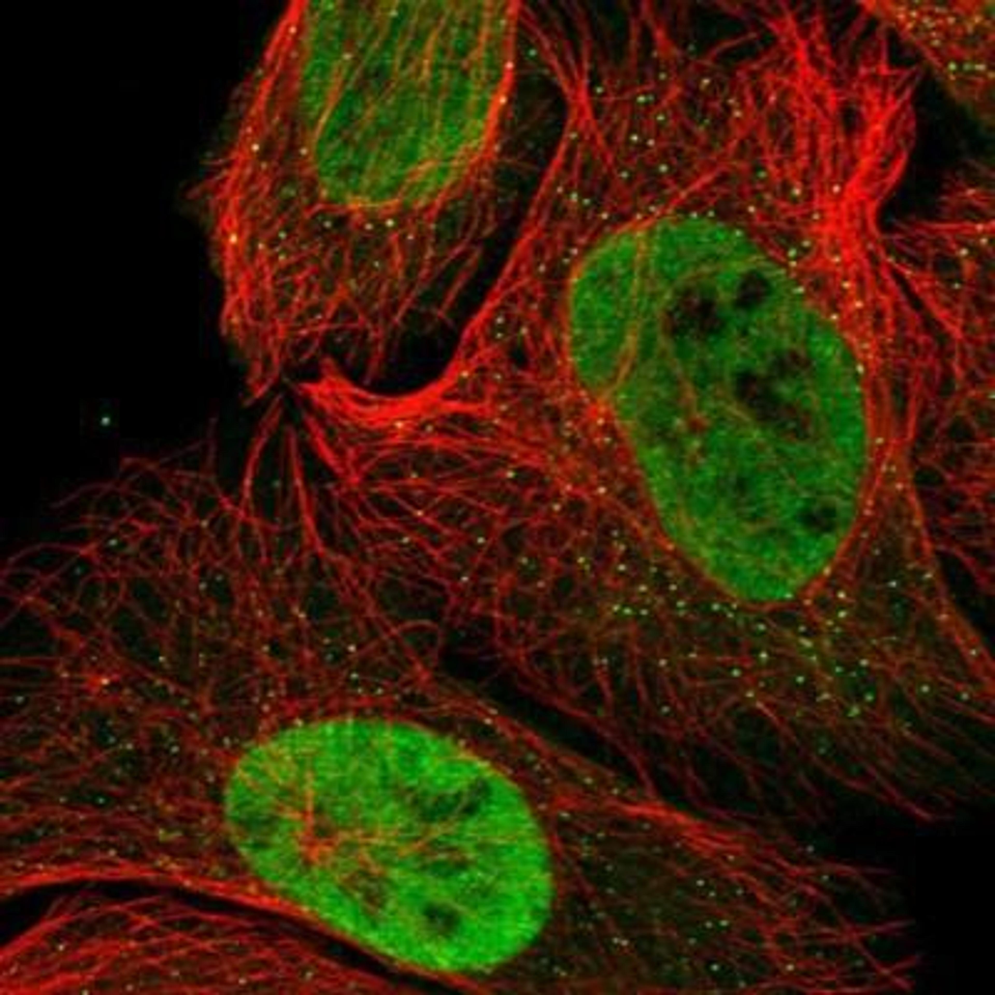 Immunocytochemistry/Immunofluorescence: BRM Antibody [NBP1-90015] - Staining of human cell line U-2 OS shows positivity in nucleus but not nucleoli & vesicles.