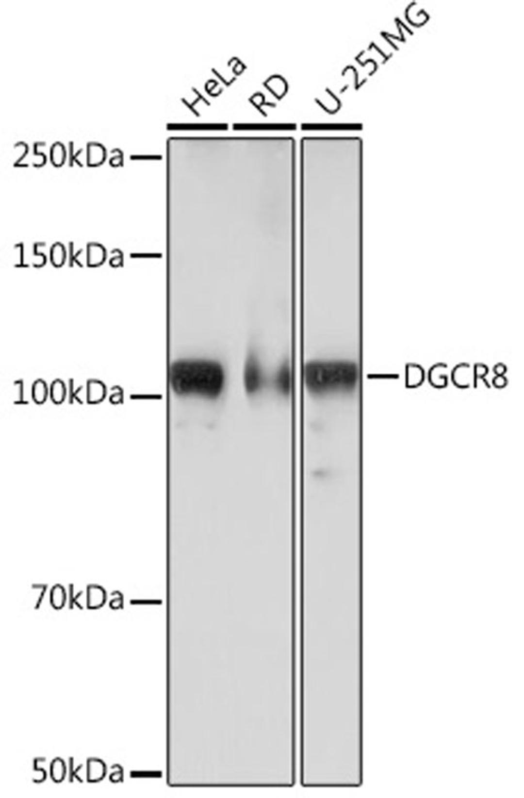 Western blot - DGCR8 Rabbit mAb (A3977)