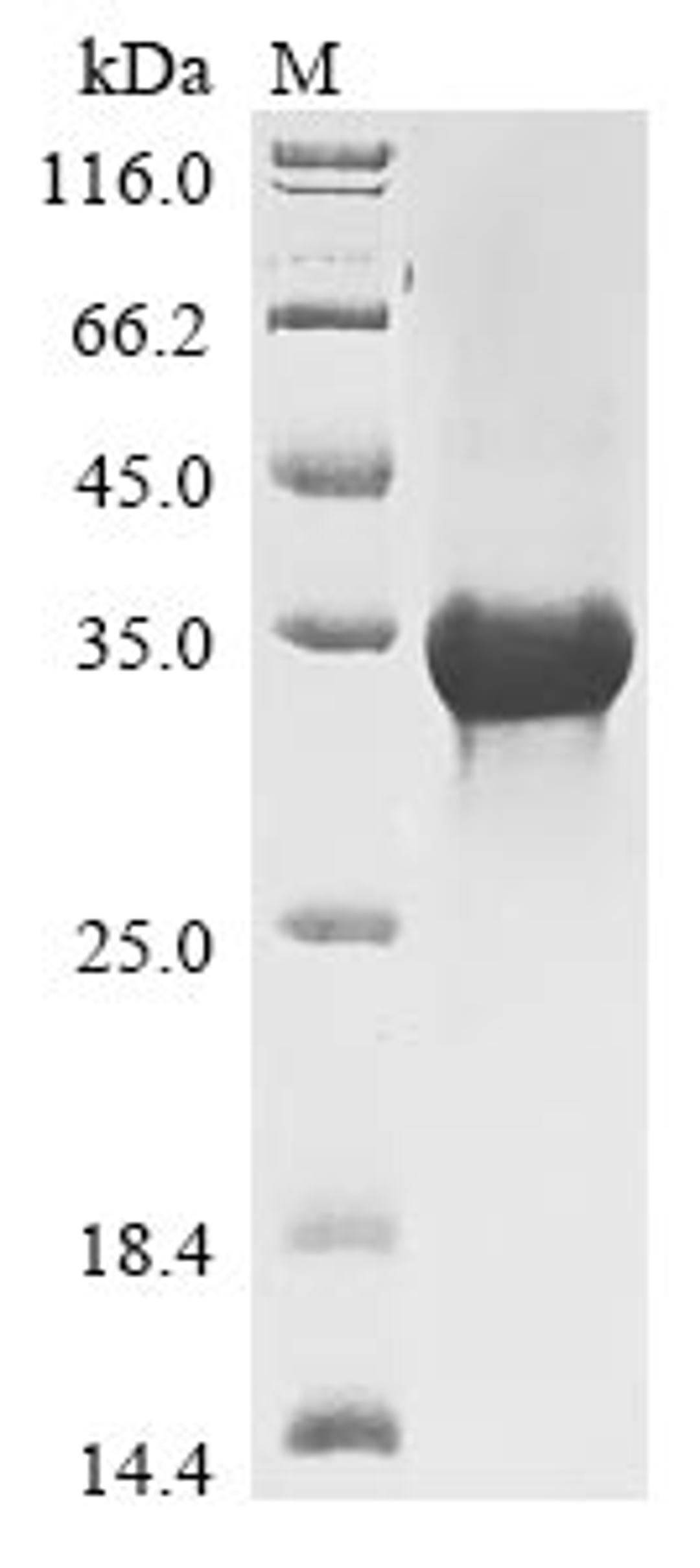 (Tris-Glycine gel) Discontinuous SDS-PAGE (reduced) with 5% enrichment gel and 15% separation gel.