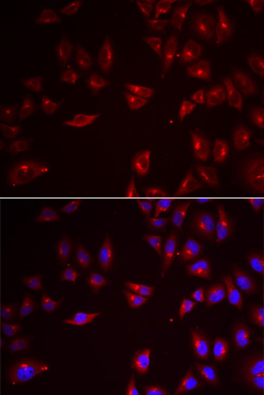 Immunofluorescence - PRAME antibody (A6456)