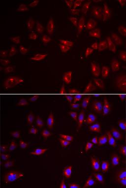 Immunofluorescence - PRAME antibody (A6456)