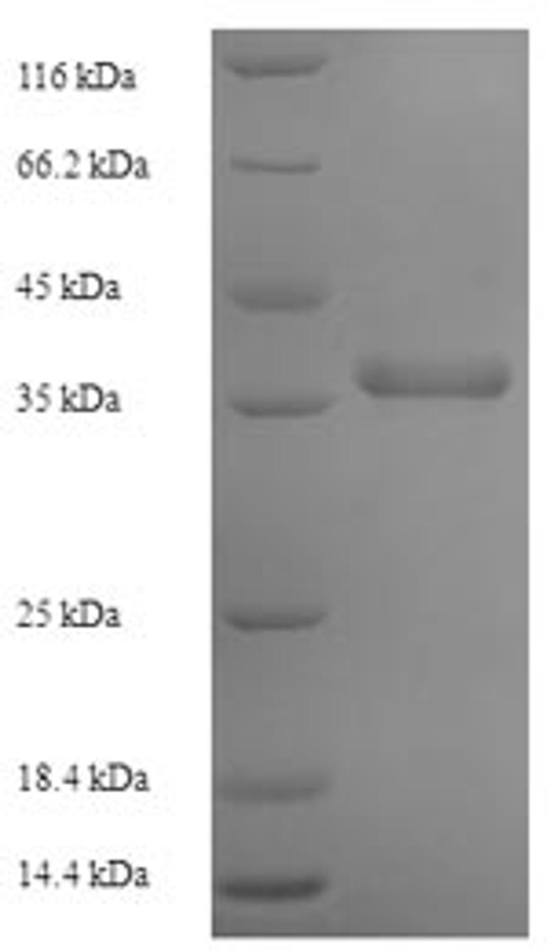 (Tris-Glycine gel) Discontinuous SDS-PAGE (reduced) with 5% enrichment gel and 15% separation gel.