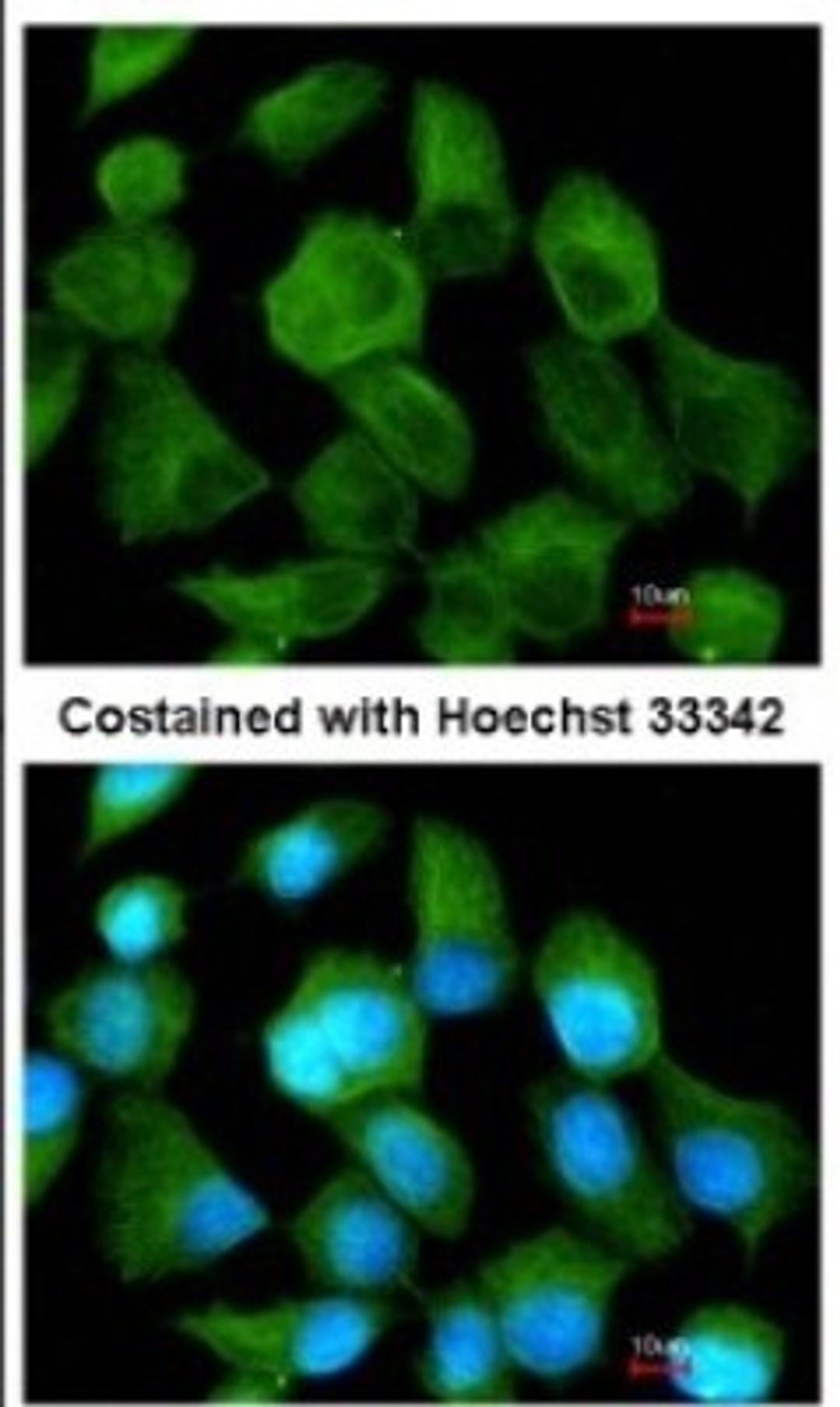 Immunocytochemistry/Immunofluorescence: TPP1 Antibody [NBP1-31758] - Analysis of methanol-fixed A431, using antibody at 1:200 dilution.