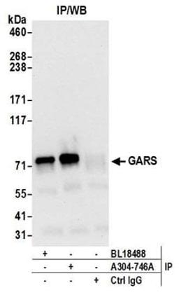 Detection of human GARS by western blot of immunoprecipitates.