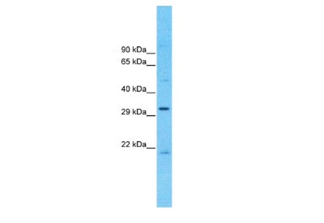 Western Blot: CCDC90A Antibody [NBP1-91586] - OVCAR-3 Cell lysates, Antibody Dilution: 1.0 ug/ml.