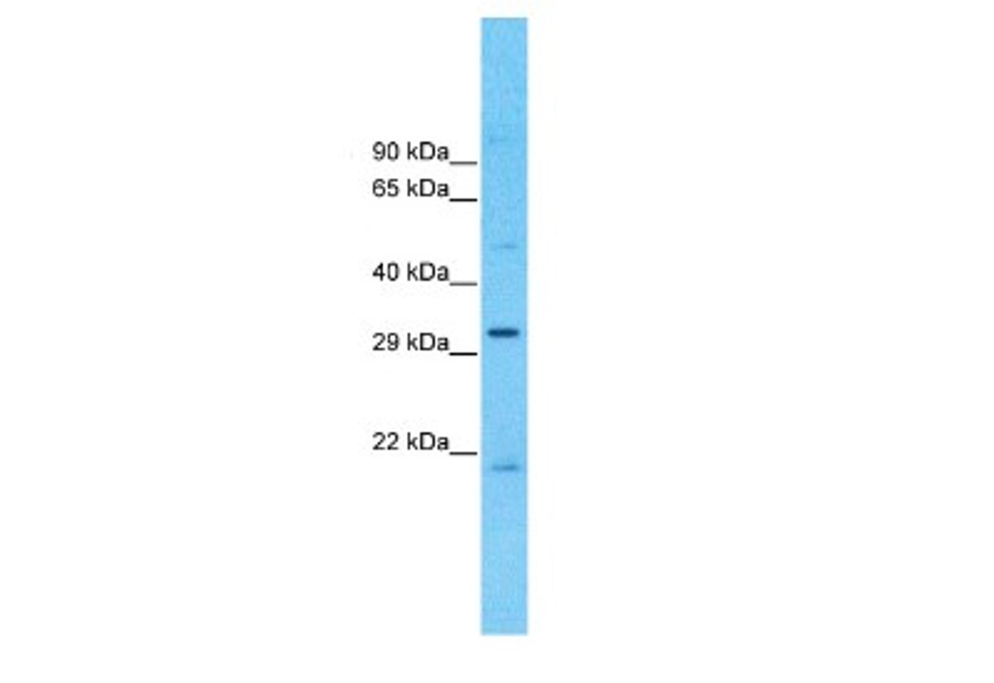 Western Blot: CCDC90A Antibody [NBP1-91586] - OVCAR-3 Cell lysates, Antibody Dilution: 1.0 ug/ml.