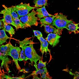 Immunofluorescence analysis of neuroblastoma cell line sk-n-be using Protocadherin Gamma A antibody