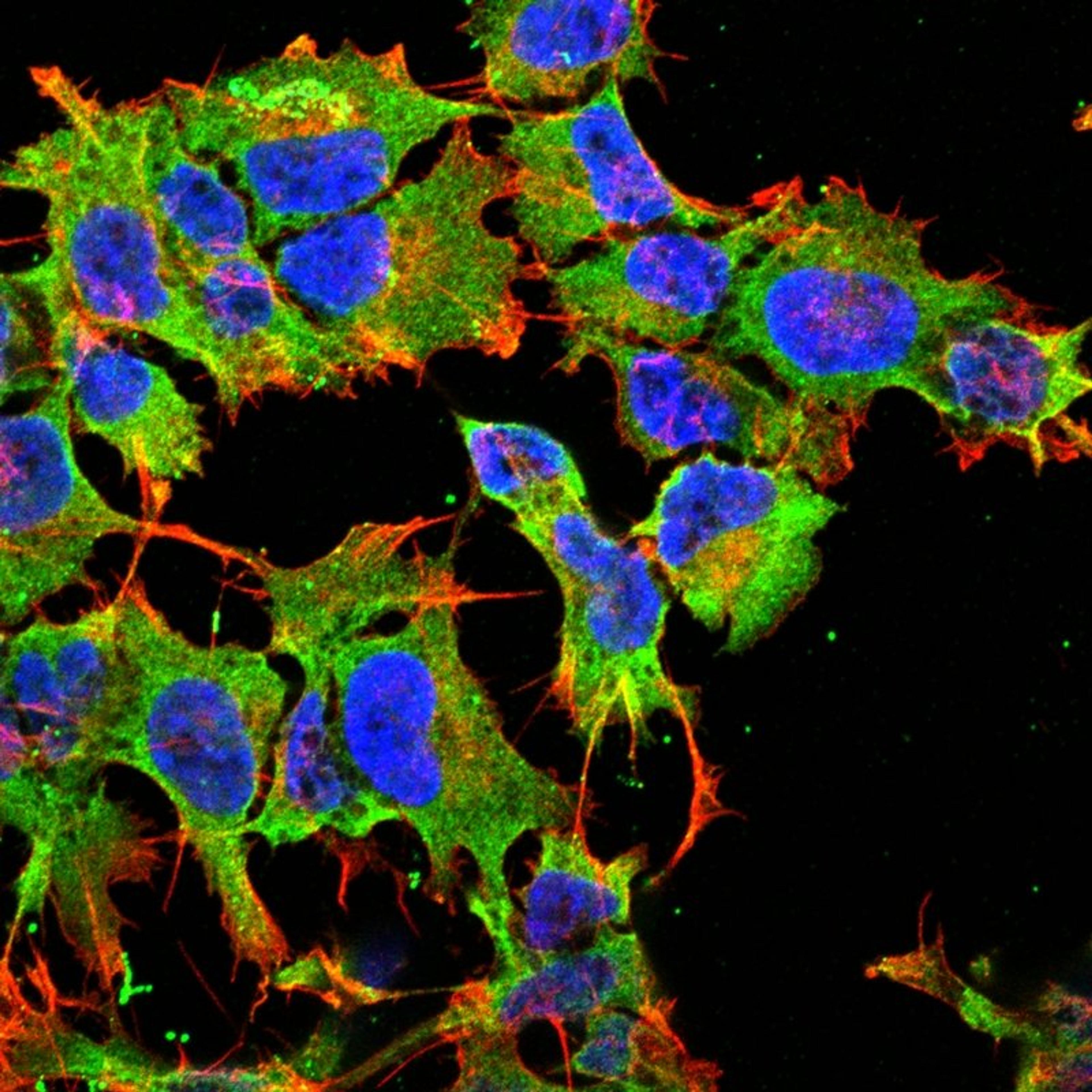 Immunofluorescence analysis of neuroblastoma cell line sk-n-be using Protocadherin Gamma A antibody