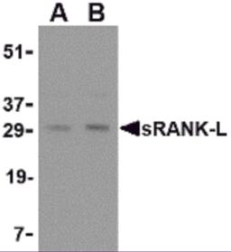 Western blot analysis of sRANK-L in rat liver tissue lysate with sRANK-L antibody at (A) 0.25 and (B) 0.5 &#956;g/mL.