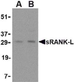 Western blot analysis of sRANK-L in rat liver tissue lysate with sRANK-L antibody at (A) 0.25 and (B) 0.5 μg/mL.