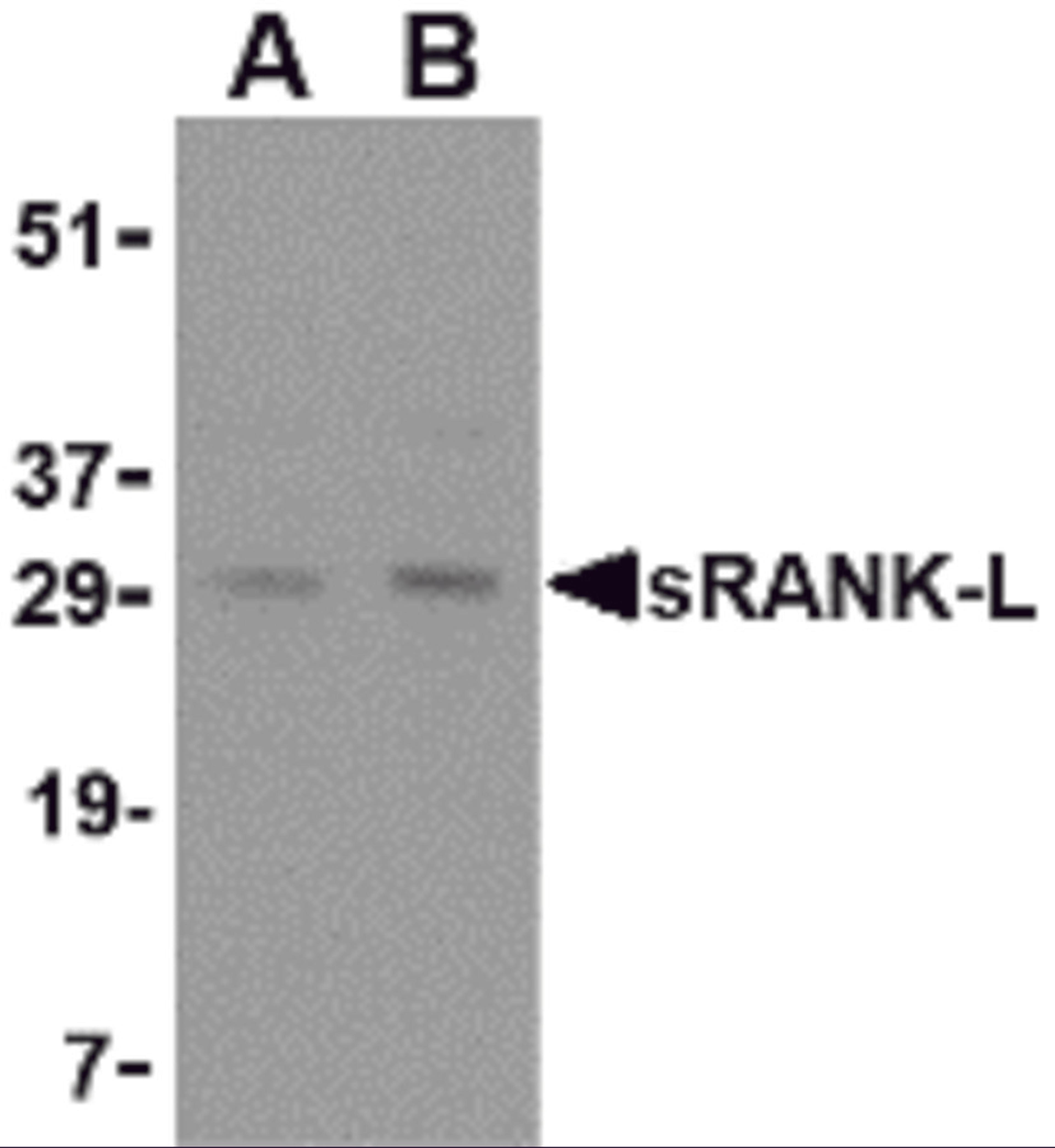 Western blot analysis of sRANK-L in rat liver tissue lysate with sRANK-L antibody at (A) 0.25 and (B) 0.5 μg/mL.