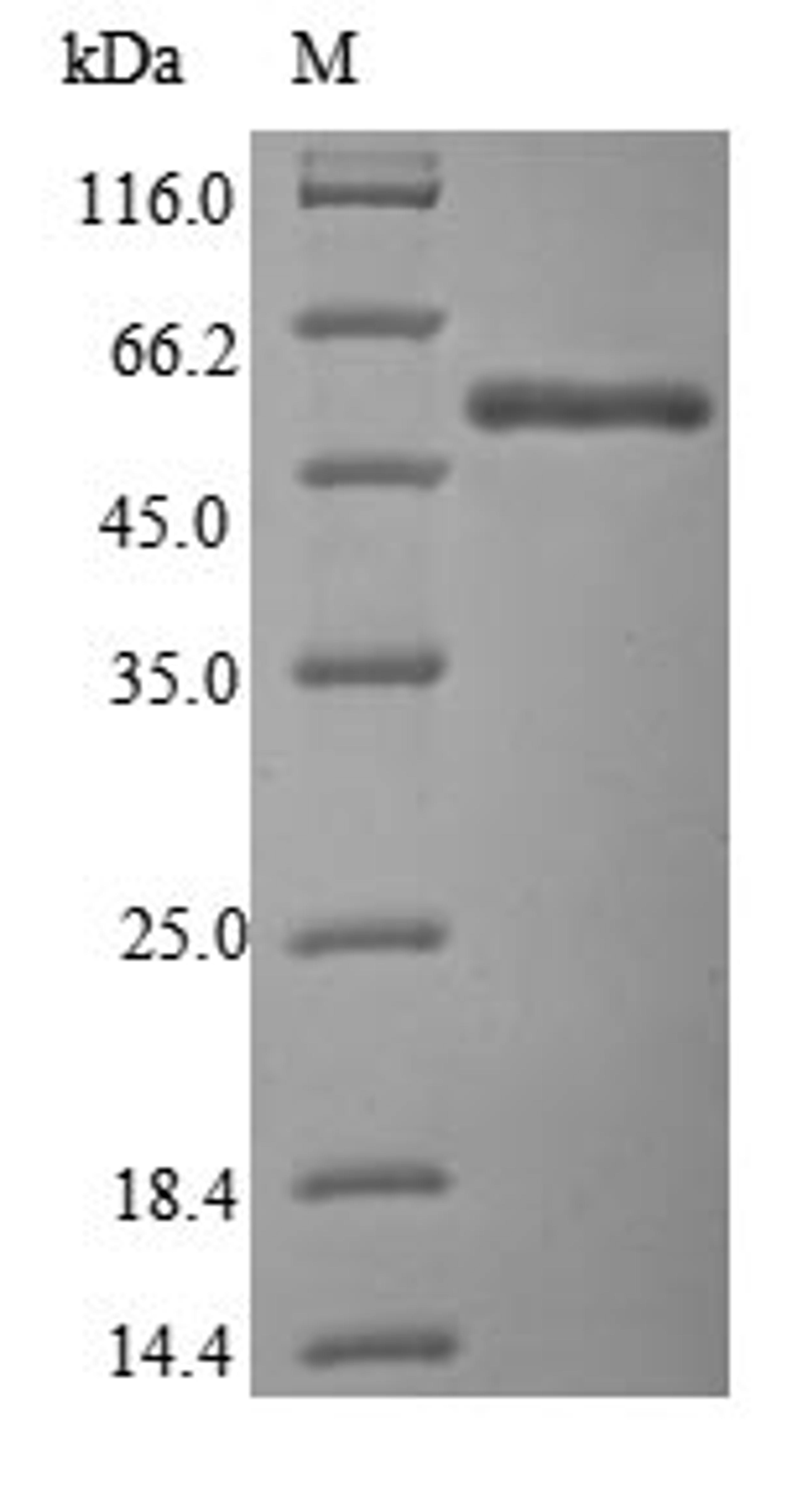 (Tris-Glycine gel) Discontinuous SDS-PAGE (reduced) with 5% enrichment gel and 15% separation gel.