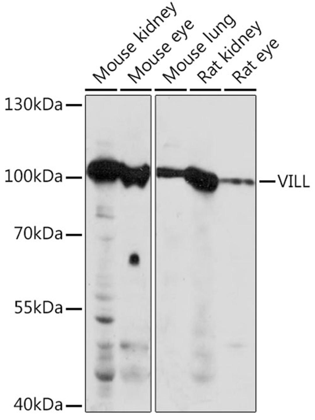 Western blot - VILL Rabbit pAb (A15440)