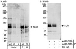 Detection of human and mouse TLK1 by western blot (h & m) and immunoprecipitation (h).