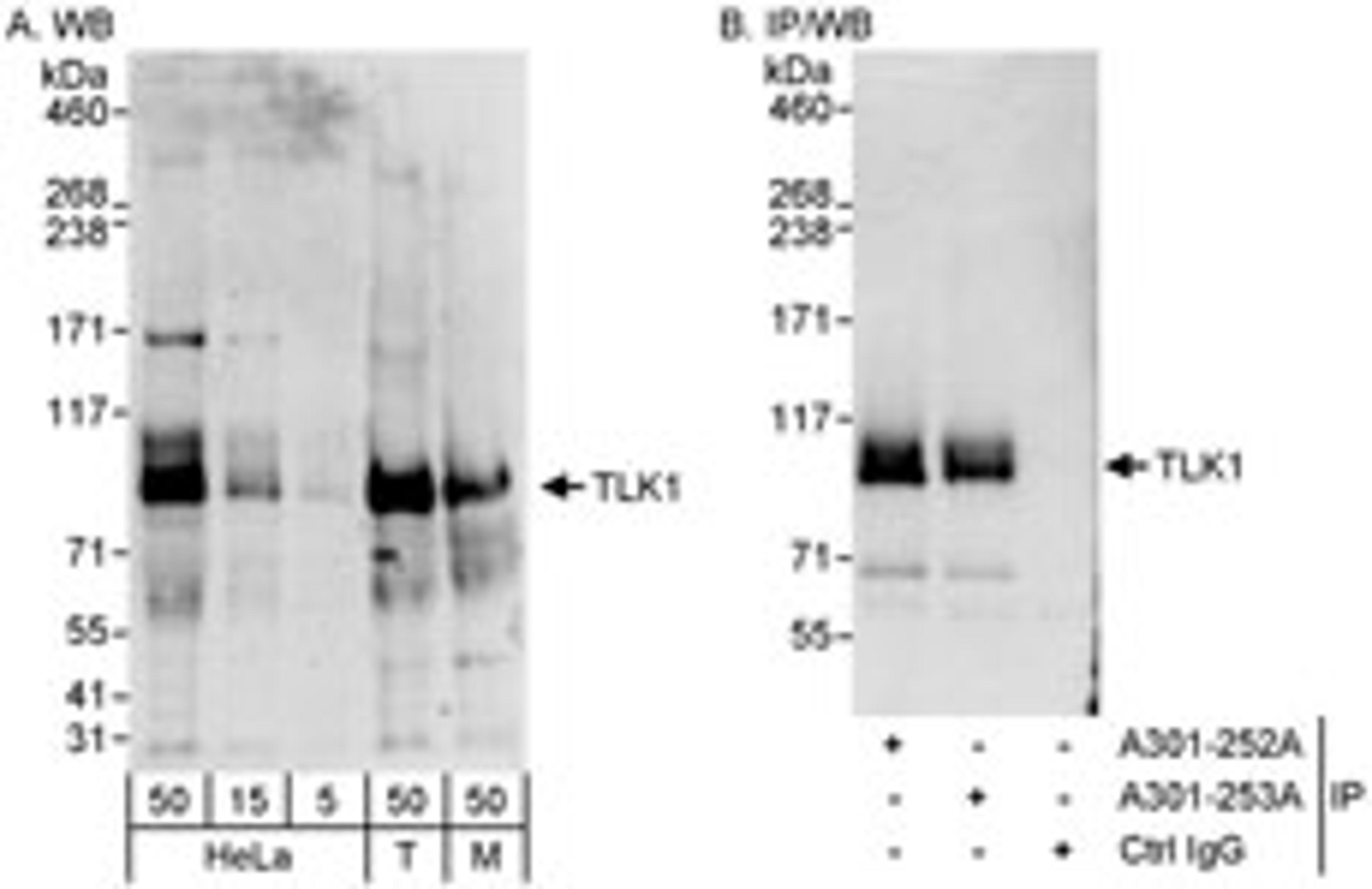 Detection of human and mouse TLK1 by western blot (h & m) and immunoprecipitation (h).