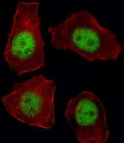 Immunofluorescense analysis of A549 cell using TBX21 antibody (primary antibody dilution at: 1:10-50)