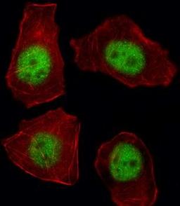 Immunofluorescense analysis of A549 cell using TBX21 antibody (primary antibody dilution at: 1:10-50)