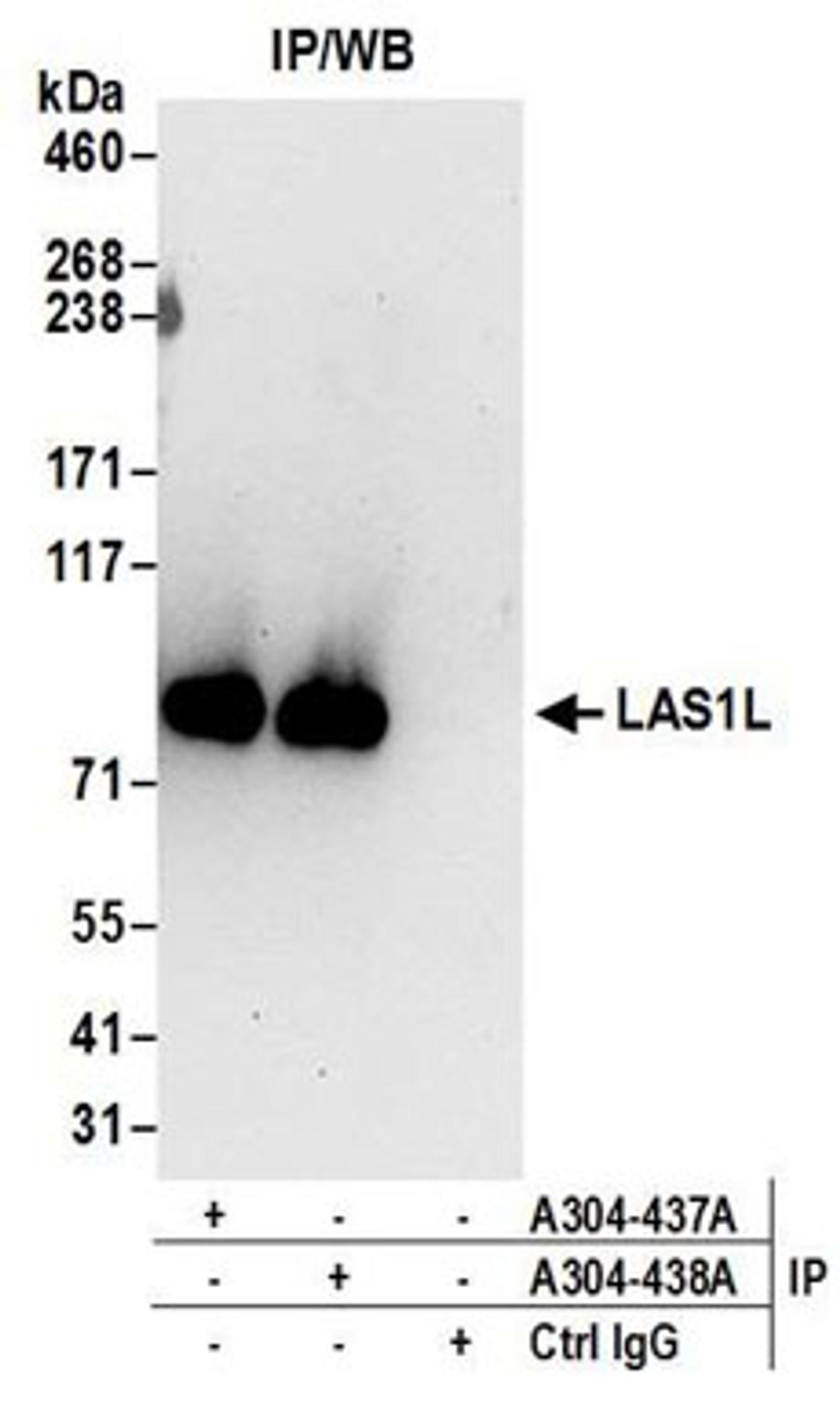 Detection of human LAS1L by western blot of immunoprecipitates.