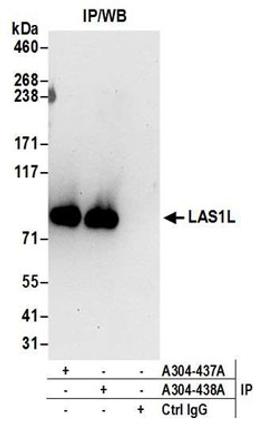 Detection of human LAS1L by western blot of immunoprecipitates.