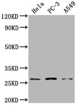 Western Blot. Positive WB detected in: Hela whole cell lysate, PC-3 whole cell lysate, A549 whole cell lysate. All lanes: RAB23 antibody at 1:2000. Secondary. Goat polyclonal to rabbit IgG at 1/50000 dilution. Predicted band size: 27 kDa. Observed band size: 27 kDa. 