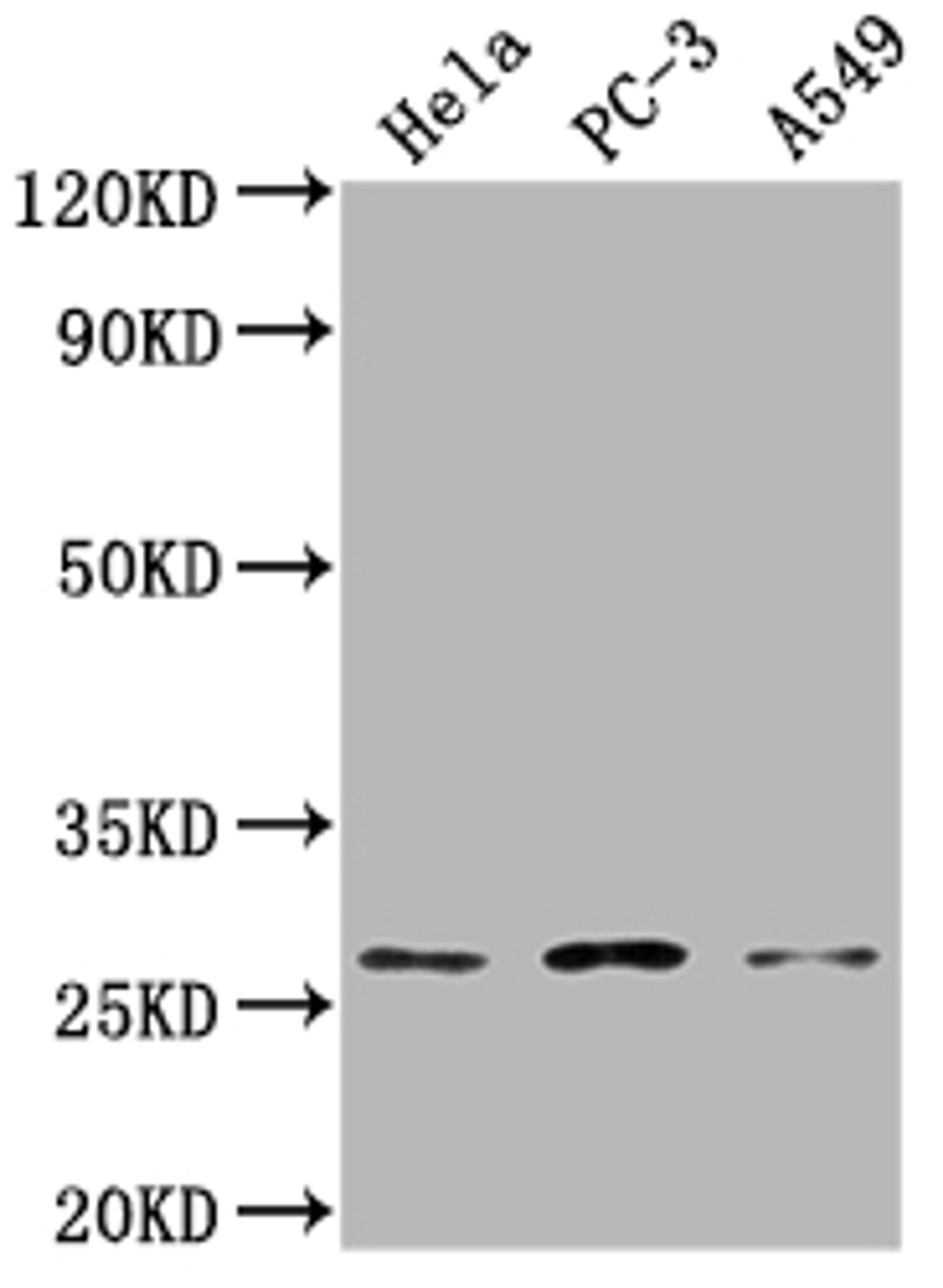 Western Blot. Positive WB detected in: Hela whole cell lysate, PC-3 whole cell lysate, A549 whole cell lysate. All lanes: RAB23 antibody at 1:2000. Secondary. Goat polyclonal to rabbit IgG at 1/50000 dilution. Predicted band size: 27 kDa. Observed band size: 27 kDa. 