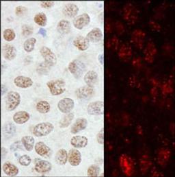 Detection of human ZNF295 by immunohistochemistry.