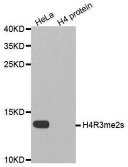 Western blot analysis of extracts of HeLa cell line and H4 protein expressed in E.coli using HIST2H4A antibody