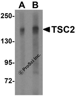 Western blot analysis of TSC2 in L1210 cell lysate with TSC2 antibody at (A) 2 and (B) 4 μg/mL.