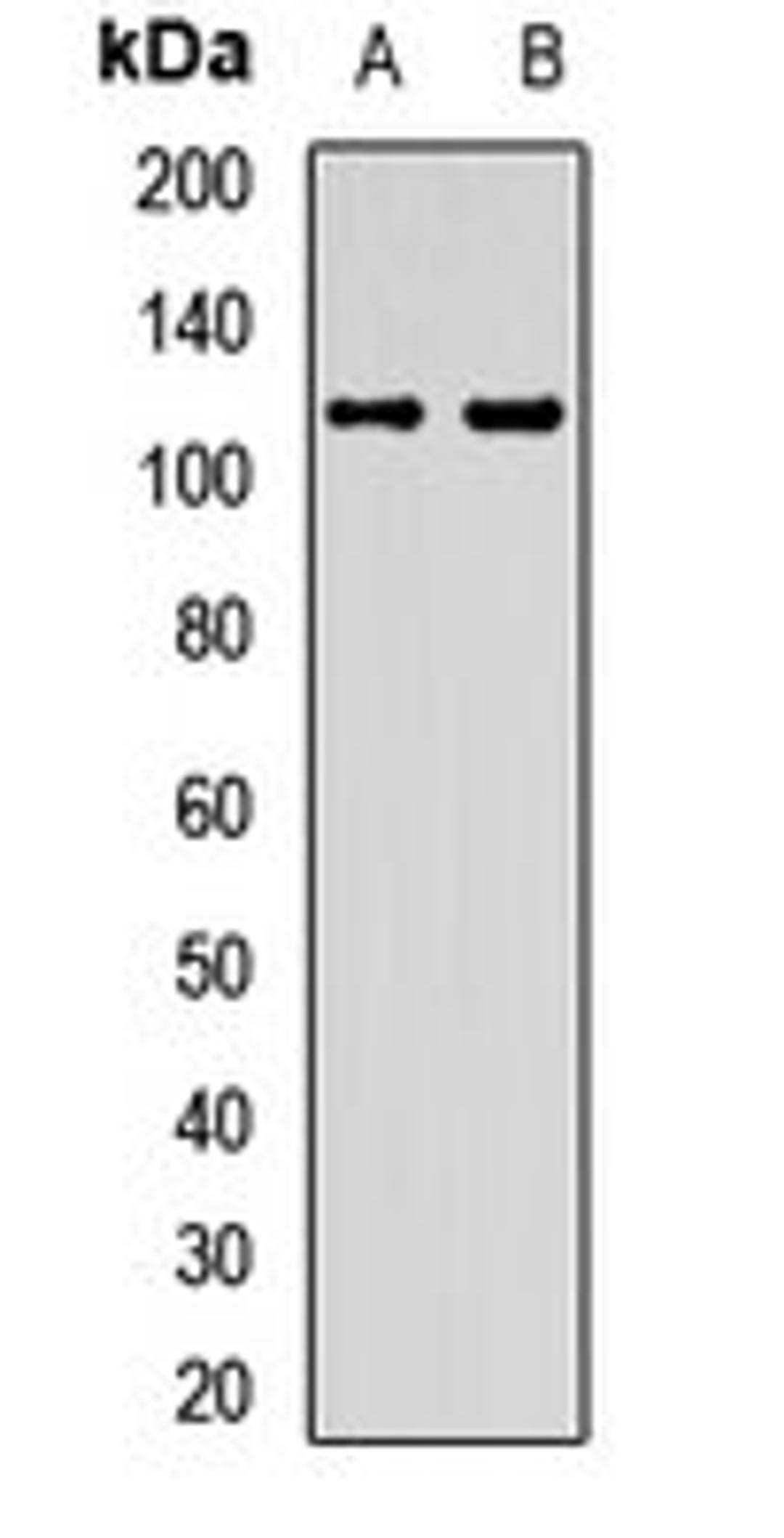 Western blot analysis of Jurkat (Lane1), HL60 (Lane2) whole cell lysates using EMC1 antibody