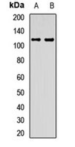 Western blot analysis of Jurkat (Lane1), HL60 (Lane2) whole cell lysates using EMC1 antibody