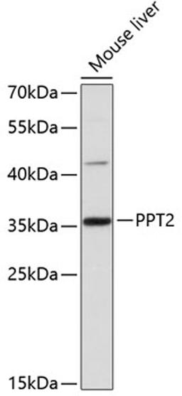 Western blot - PPT2 antibody (A12251)