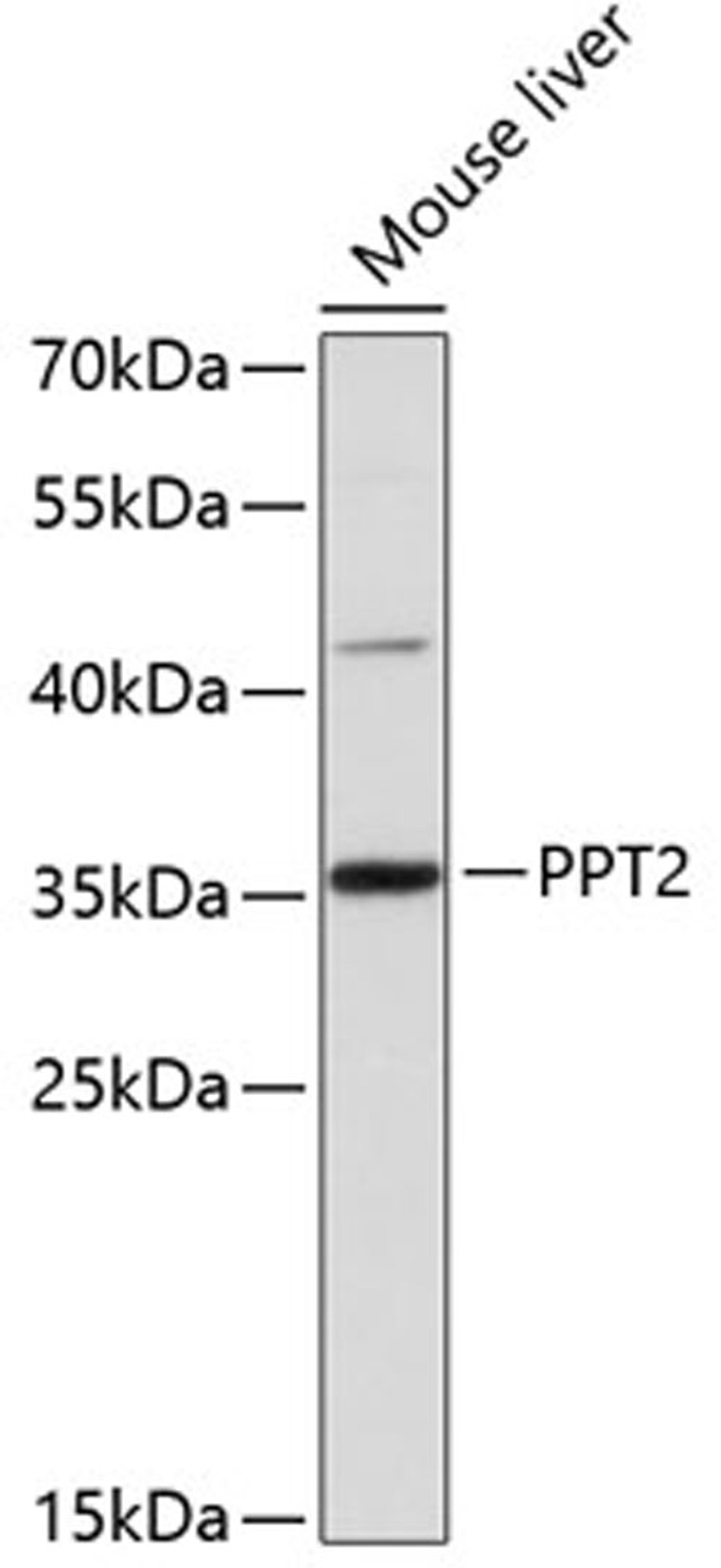 Western blot - PPT2 antibody (A12251)