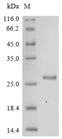 (Tris-Glycine gel) Discontinuous SDS-PAGE (reduced) with 5% enrichment gel and 15% separation gel.