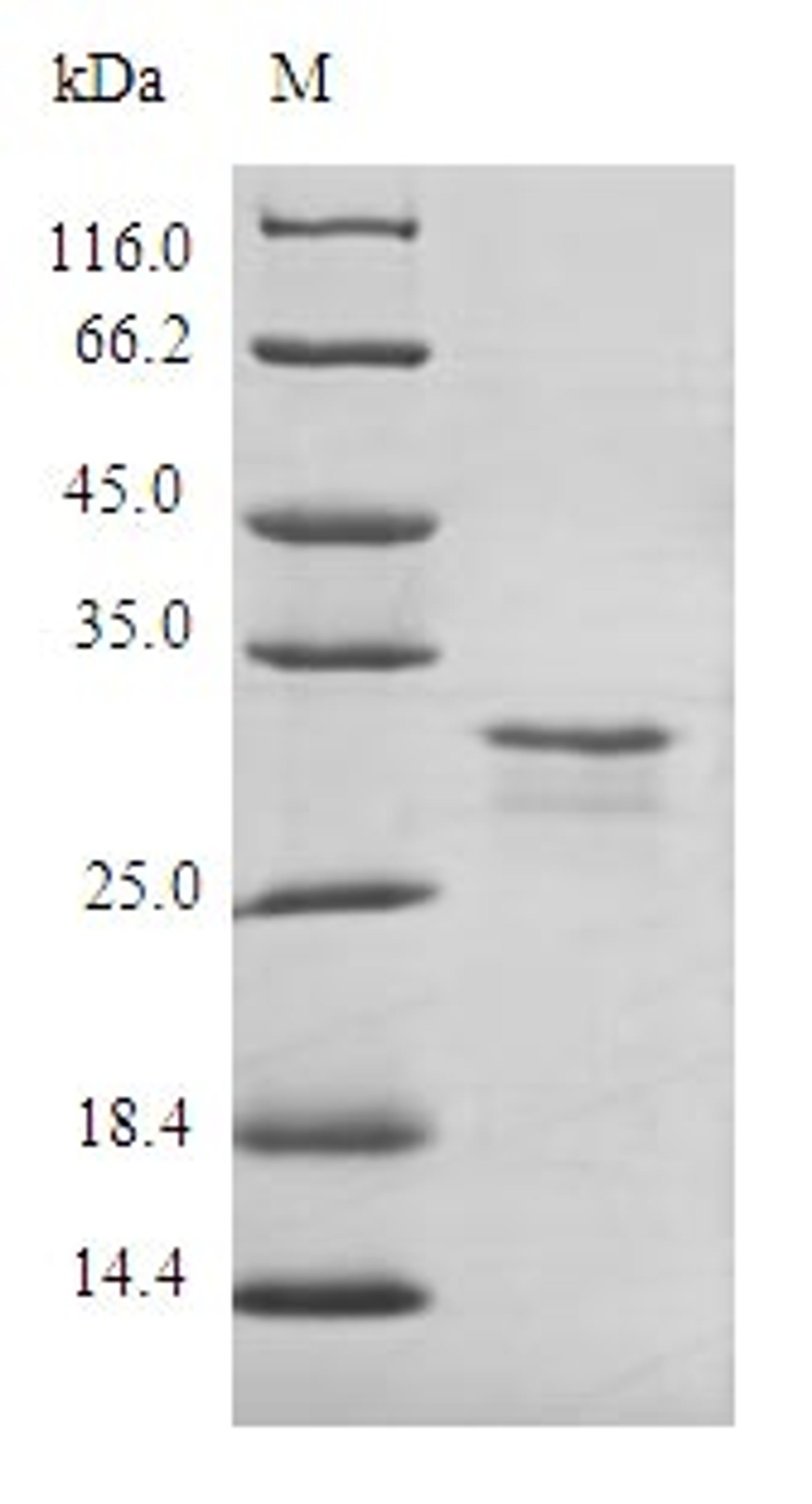 (Tris-Glycine gel) Discontinuous SDS-PAGE (reduced) with 5% enrichment gel and 15% separation gel.