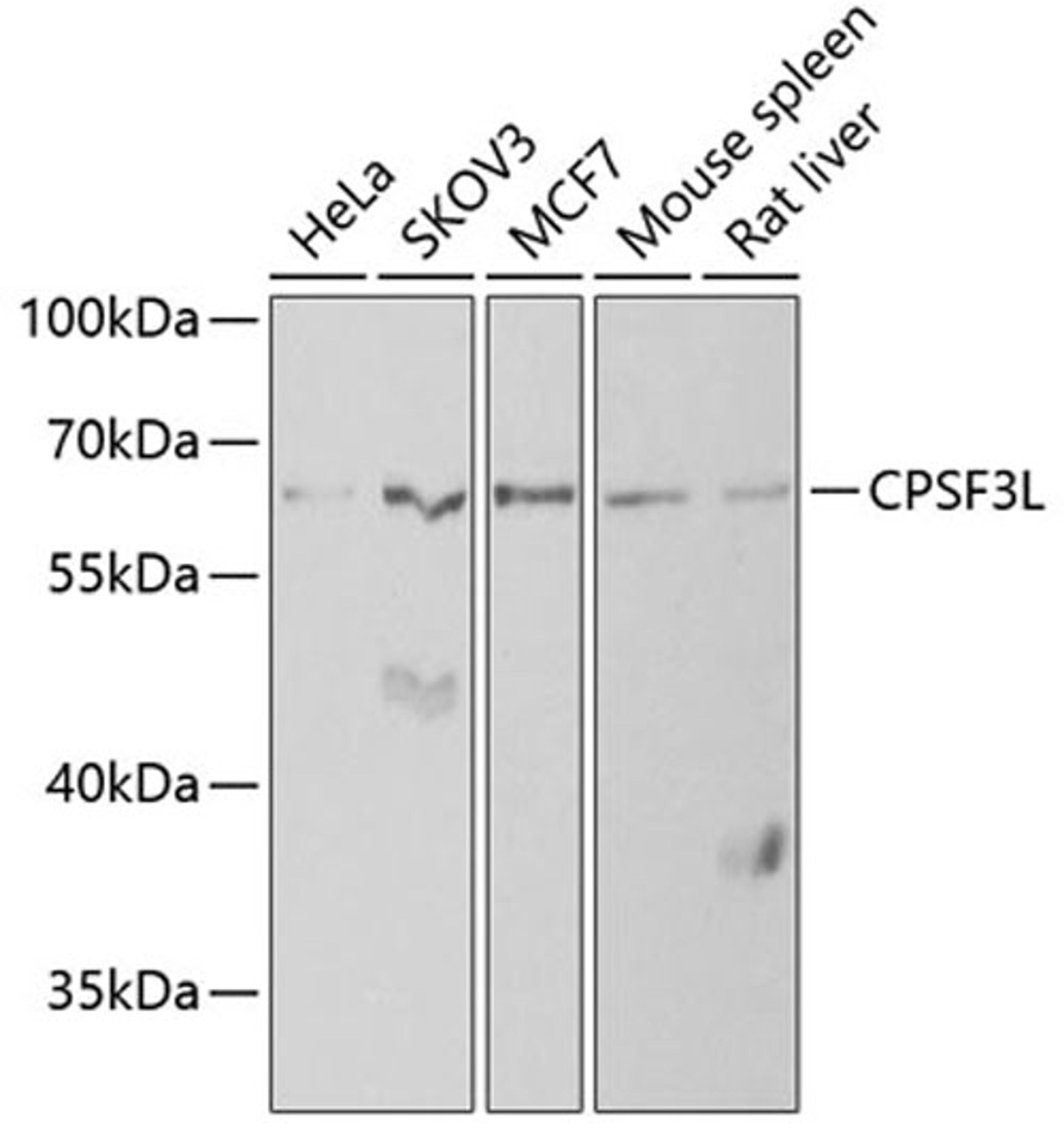 Western blot - CPSF3L antibody (A6566)