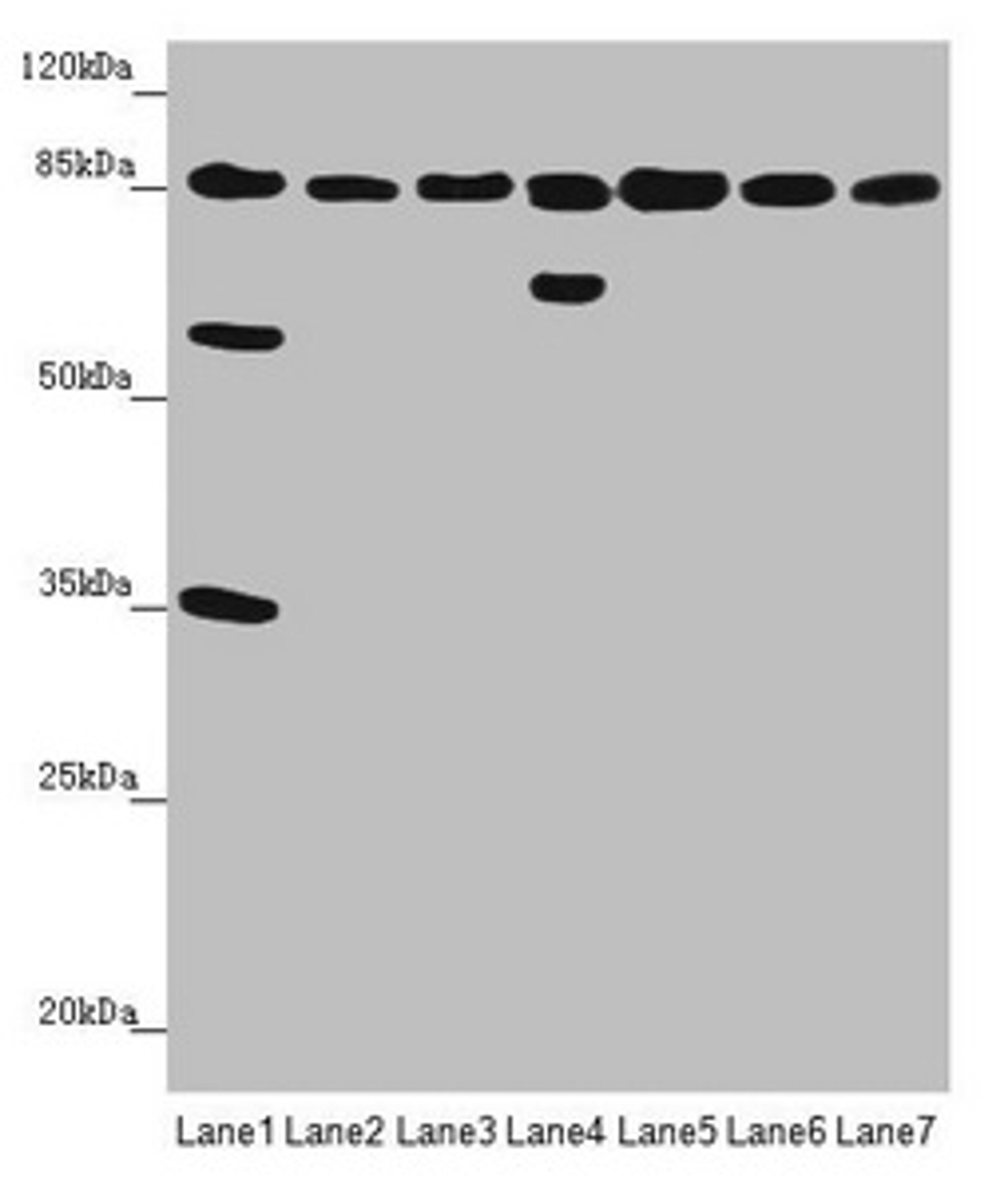 Western blot. All lanes: NELL1 antibody at 3.47 ug/ml. Lane 1: Mouse liver tissue. Lane 2: Mouse kidney tissue. Lane 3: Mouse spleen tissue. Lane 4: Human placenta tissue. Lane 5: Hela whole cell lysate. Lane 6: Jurkat whole cell lysate. Lane 7: MCF-7 whole cell lysate. Secondary. Goat polyclonal to rabbit IgG at 1/10000 dilution. Predicted band size: 90, 85 kDa. Observed band size: 90, 65, 58, 35 kDa.