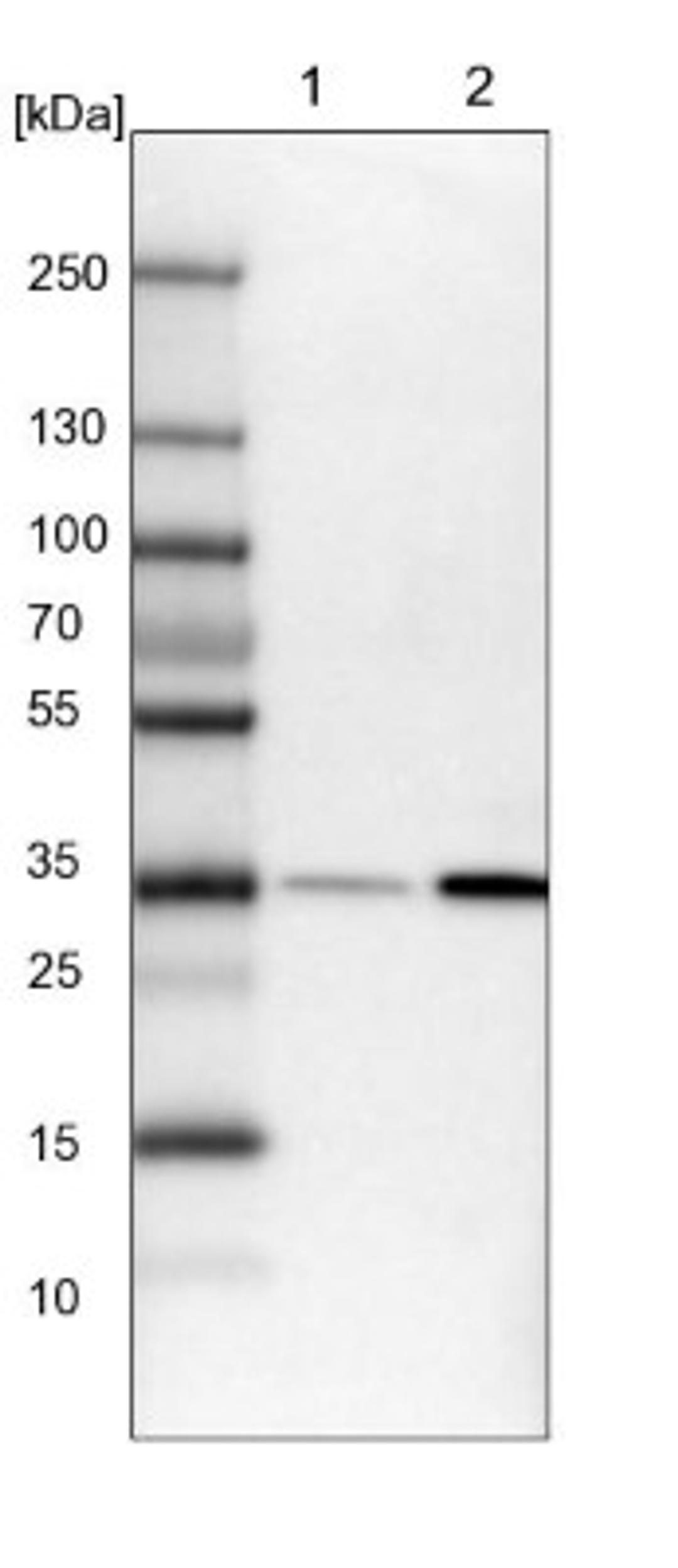 Western Blot: P15RS Antibody [NBP1-87917] - Lane 1: NIH-3T3 cell lysate (Mouse embryonic fibroblast cells)<br/>Lane 2: NBT-II cell lysate (Rat Wistar bladder tumour cells)