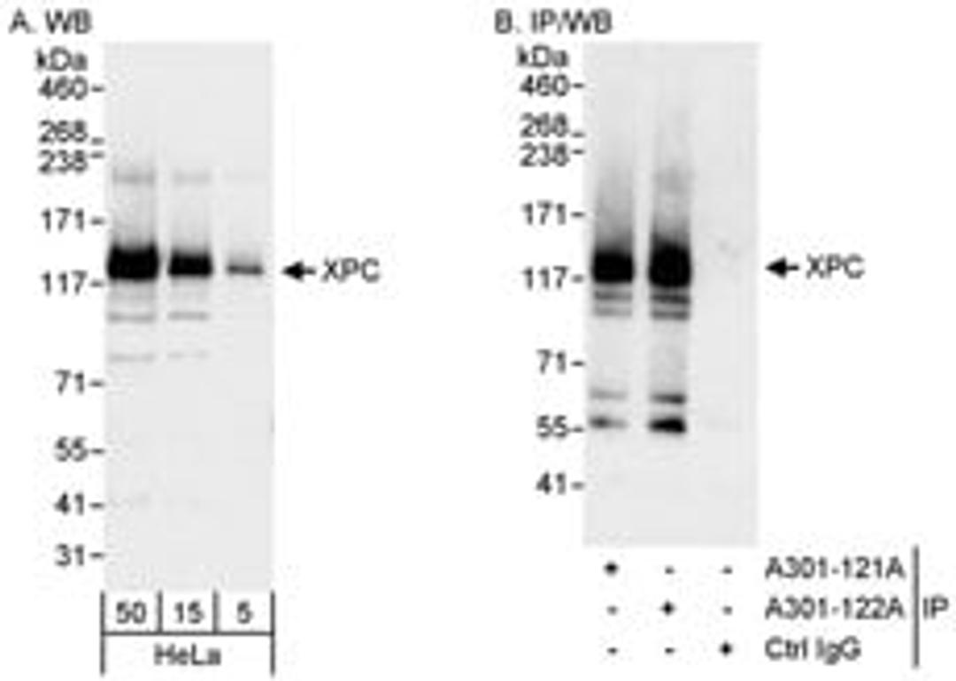 Detection of human XPC by western blot and immunoprecipitation.