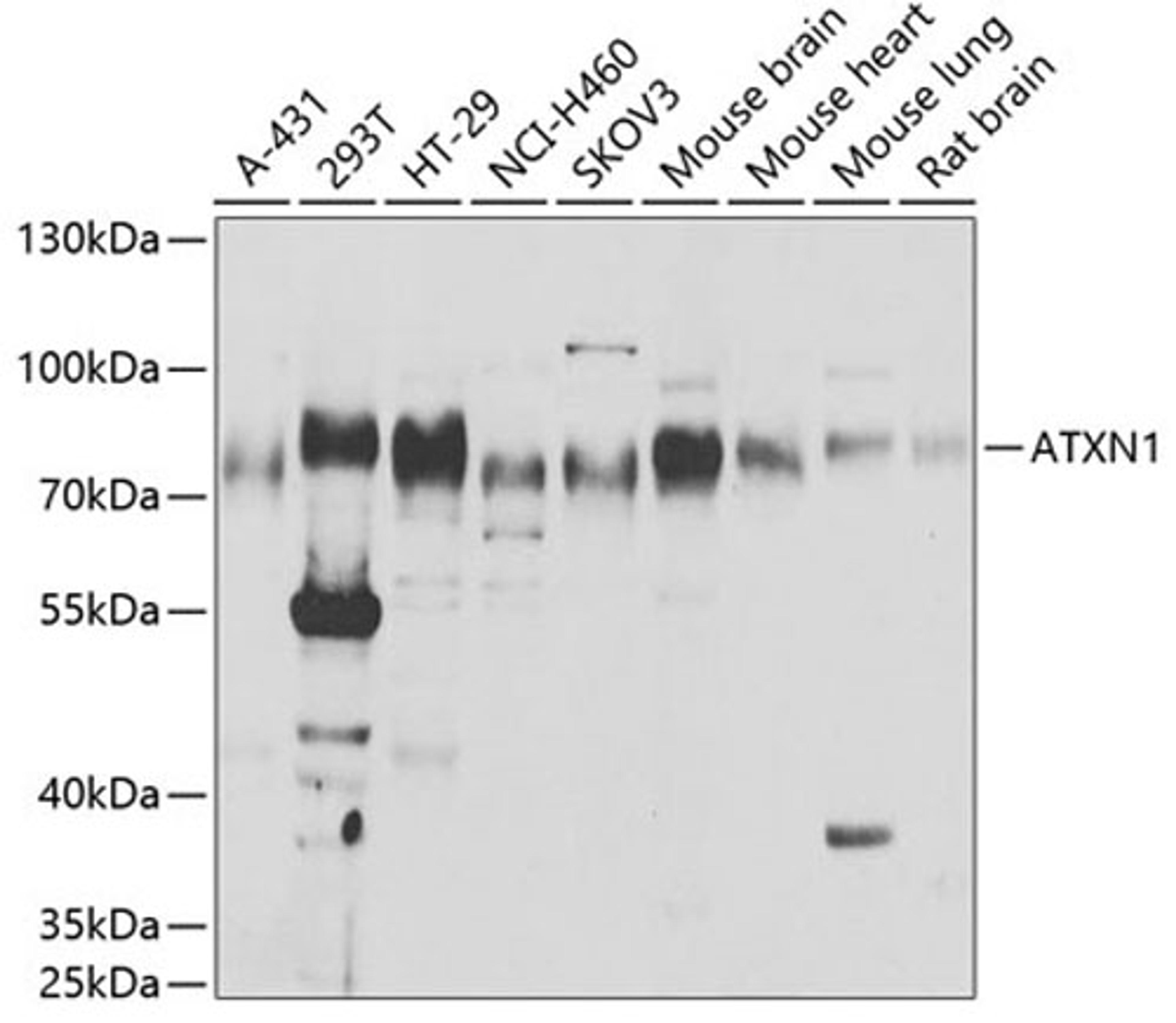 Western blot - ATXN1 antibody (A6217)