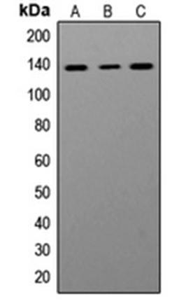 Western blot analysis of Jurkat (Lane 1), Ramos (Lane 2), HeLa (Lane 3) whole cell lysates using ADAR antibody