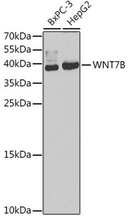 Western blot - WNT7B antibody (A7746)