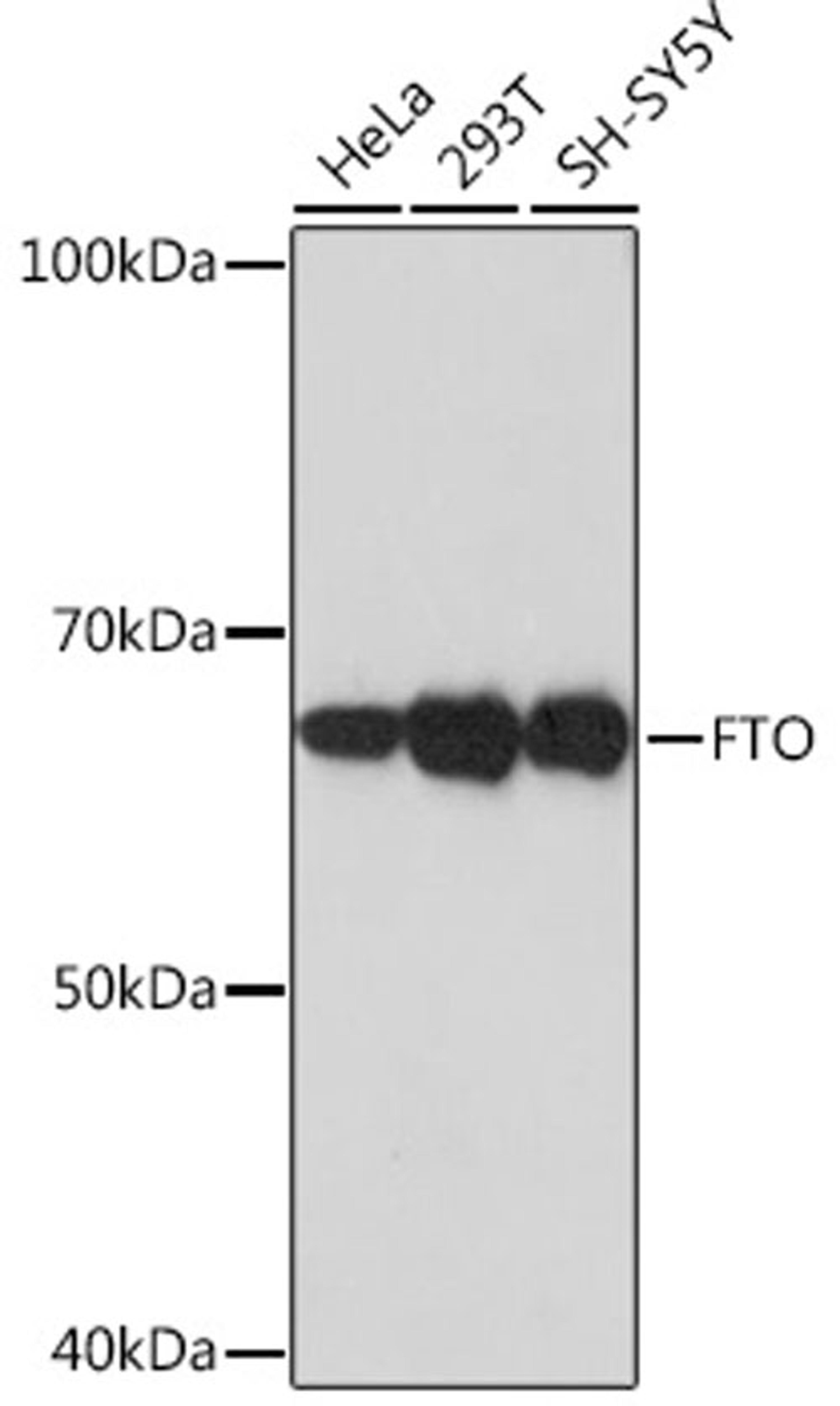 Western blot - FTO Rabbit mAb (A3861)