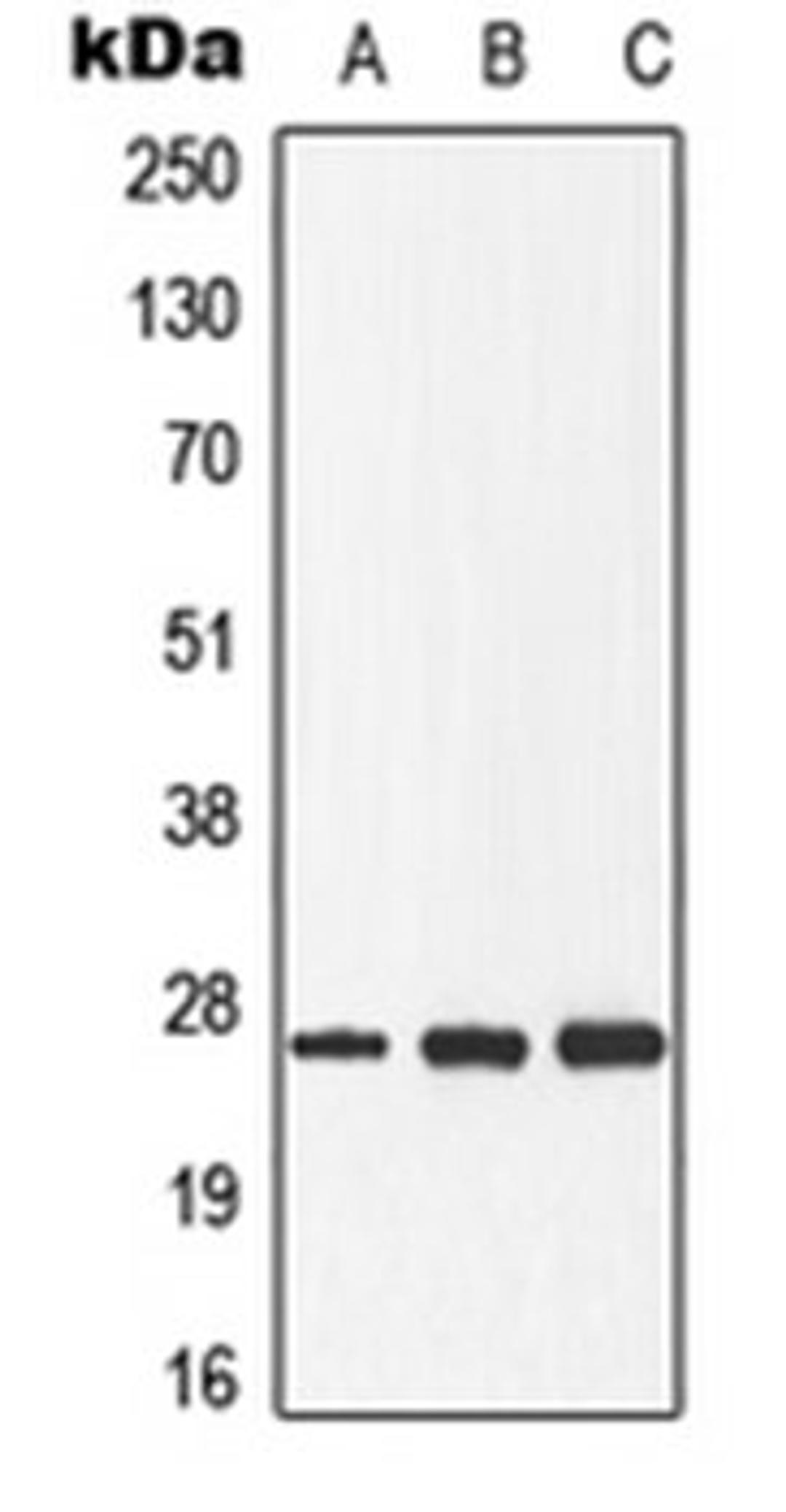 Western blot analysis of HeLa (Lane 1), Raw264.7 (Lane 2), rat spleen (Lane 3) whole cell lysates using DDIT3 antibody