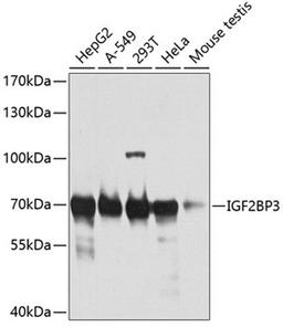 Western blot - IGF2BP3 antibody (A6099)