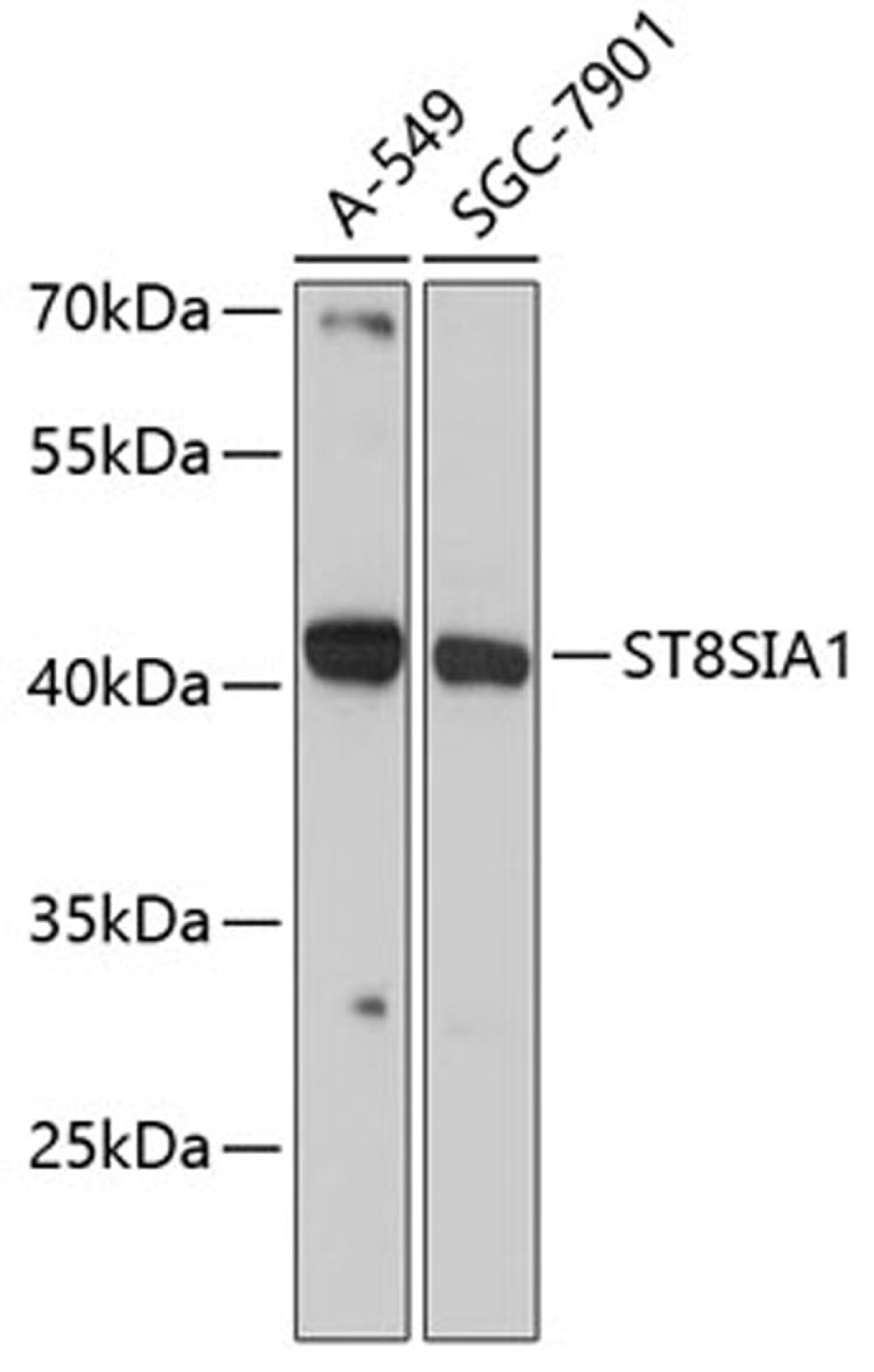 Western blot - ST8SIA1 antibody (A9648)