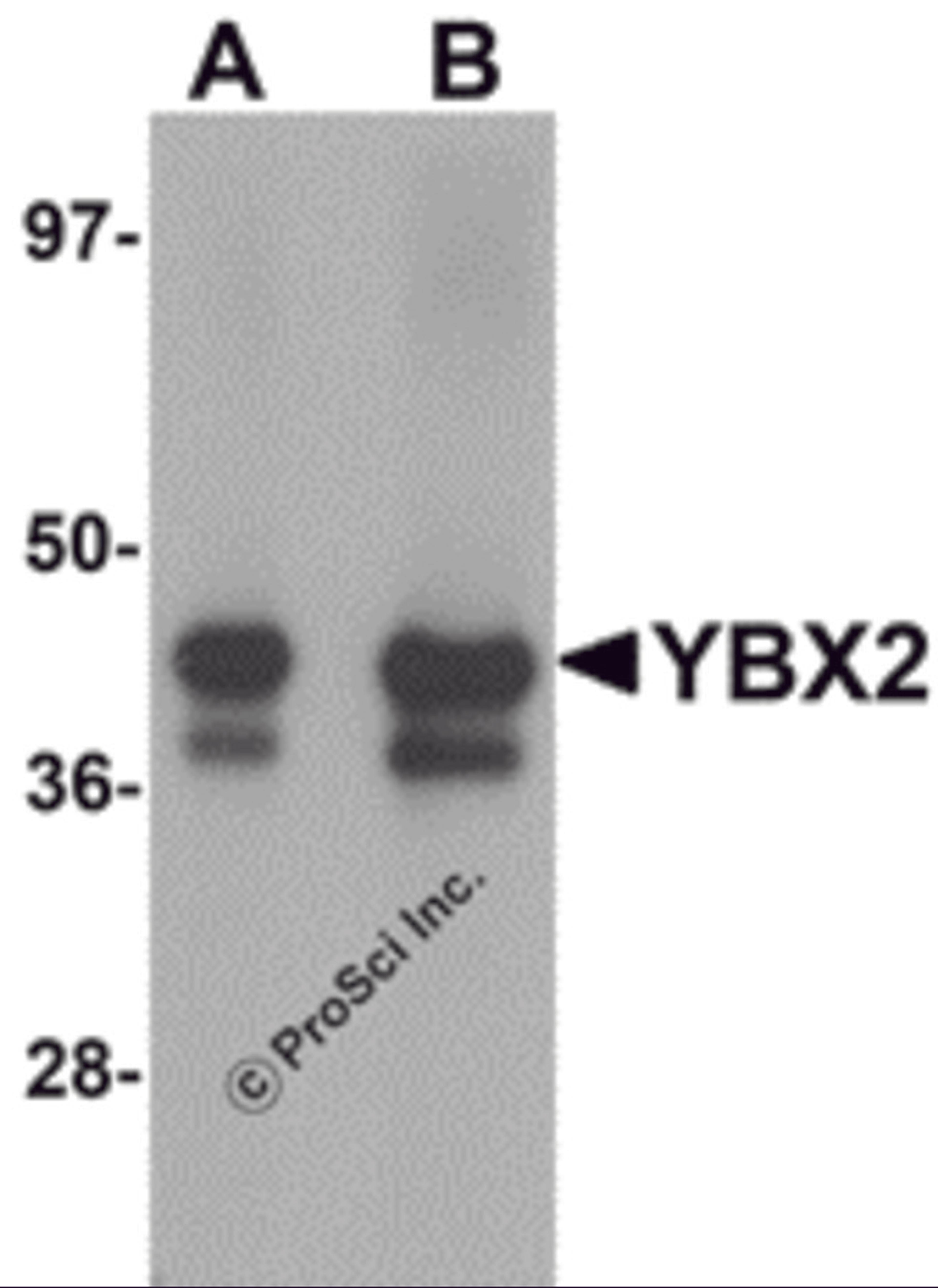 Western blot analysis of YBX2 in human testis tissue lysate with YBX2 antibody at (A) 1 and (B) 2 &#956;g/mL.