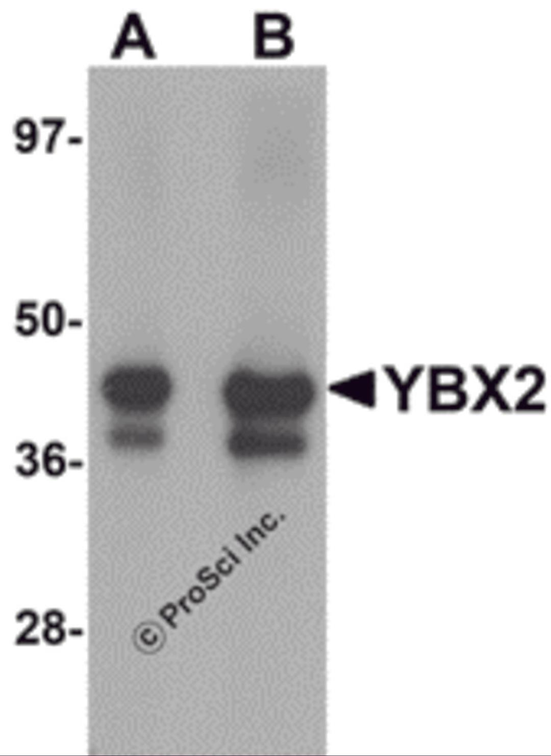 Western blot analysis of YBX2 in human testis tissue lysate with YBX2 antibody at (A) 1 and (B) 2 μg/mL.