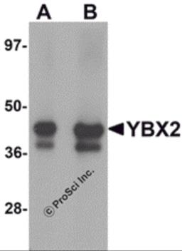 Western blot analysis of YBX2 in human testis tissue lysate with YBX2 antibody at (A) 1 and (B) 2 μg/mL.